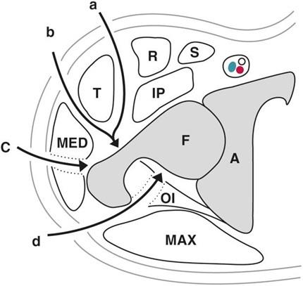 https://cdn.ncbi.nlm.nih.gov/pmc/blobs/4a35/11492015/a5197a747ebe/thc-32-thc240381-g001.jpg