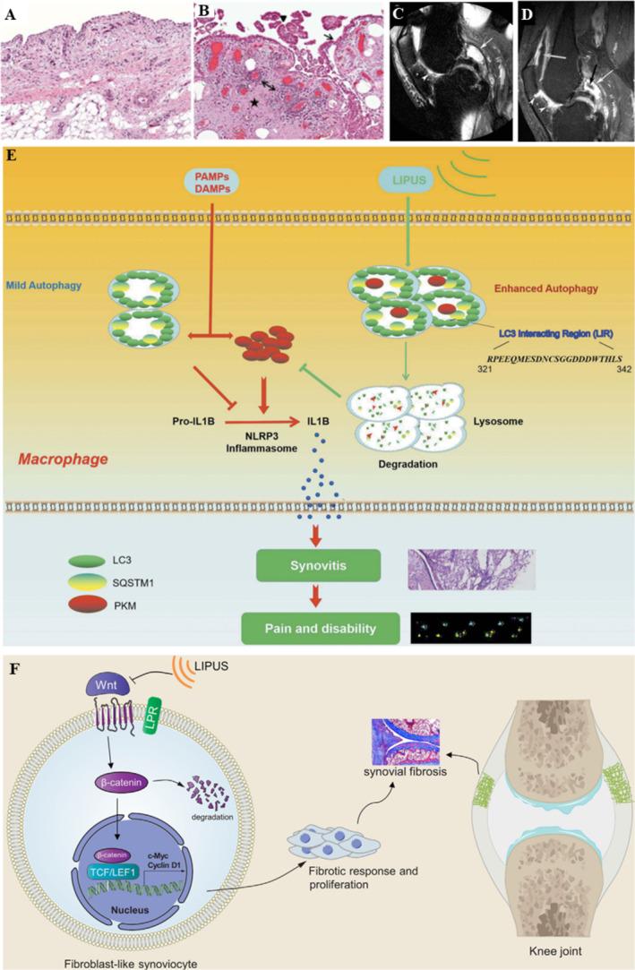 https://cdn.ncbi.nlm.nih.gov/pmc/blobs/4a36/12087415/d9ec1e33eef7/SMMD-4-e70003-g006.jpg