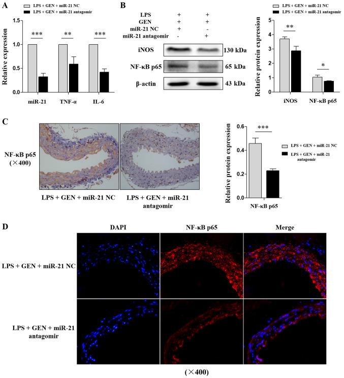 https://cdn.ncbi.nlm.nih.gov/pmc/blobs/4a3c/7809901/d4d92c129f53/mmr-23-03-11831-g03.jpg