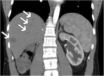 https://cdn.ncbi.nlm.nih.gov/pmc/blobs/4a43/5824467/19f73af387e7/12957_2018_1343_Fig3_HTML.jpg