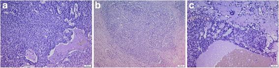 https://cdn.ncbi.nlm.nih.gov/pmc/blobs/4a43/5824467/74dd07d2c8ab/12957_2018_1343_Fig2_HTML.jpg