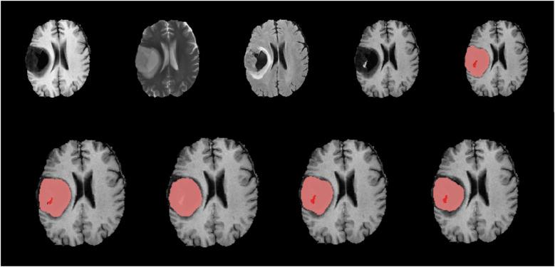 https://cdn.ncbi.nlm.nih.gov/pmc/blobs/4a44/12281592/ae2b3a592bb1/fradi-05-1616293-g005.jpg