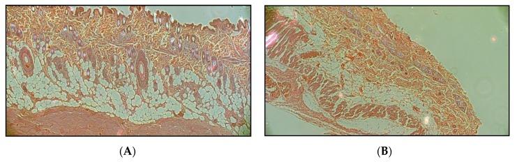 https://cdn.ncbi.nlm.nih.gov/pmc/blobs/4a46/6781558/16d489b02dd5/pharmaceutics-11-00445-g009a.jpg