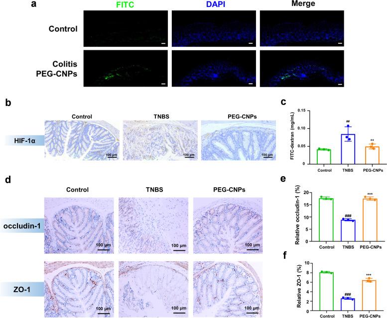 https://cdn.ncbi.nlm.nih.gov/pmc/blobs/4a47/10375752/fa7af11ad230/40824_2023_412_Fig6_HTML.jpg