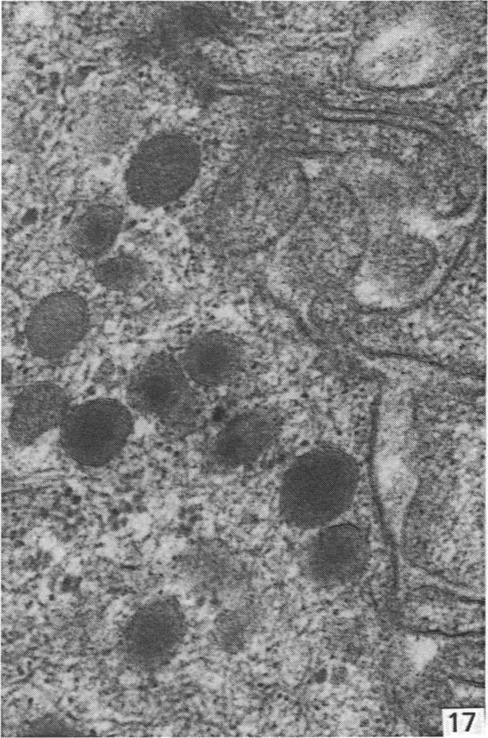 https://cdn.ncbi.nlm.nih.gov/pmc/blobs/4a4b/1261850/d99733553bfe/janat00178-0247-c.jpg