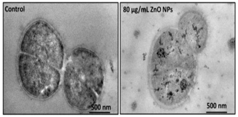 https://cdn.ncbi.nlm.nih.gov/pmc/blobs/4a52/7700383/553d57251f66/ijms-21-08836-g023.jpg