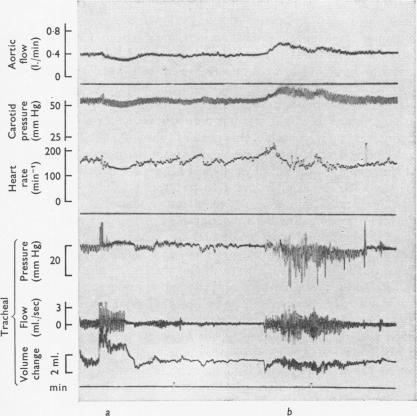 https://cdn.ncbi.nlm.nih.gov/pmc/blobs/4a5a/1331693/6f02c645af8e/jphysiol01004-0138-a.jpg