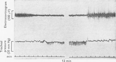 https://cdn.ncbi.nlm.nih.gov/pmc/blobs/4a5a/1331693/b7858a756e96/jphysiol01004-0141-a.jpg
