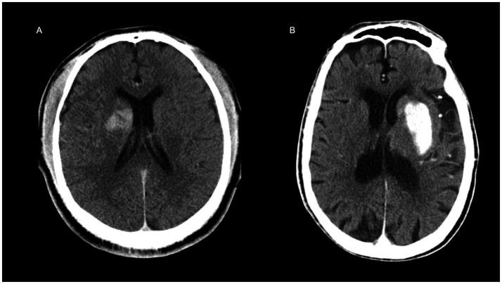 https://cdn.ncbi.nlm.nih.gov/pmc/blobs/4a5e/12367656/cb1c57f12669/fnins-19-1643014-g008.jpg