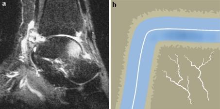 https://cdn.ncbi.nlm.nih.gov/pmc/blobs/4a64/2855020/7be36fd67fea/167_2010_1064_Fig8_HTML.jpg