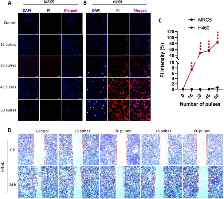 https://cdn.ncbi.nlm.nih.gov/pmc/blobs/4a67/11670698/48bae594d1e6/gr4.jpg