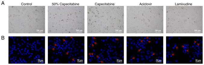 https://cdn.ncbi.nlm.nih.gov/pmc/blobs/4a67/12117538/9b1717a92b93/mmr-32-01-13568-g03.jpg