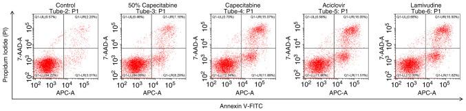 https://cdn.ncbi.nlm.nih.gov/pmc/blobs/4a67/12117538/e6d55ce139c5/mmr-32-01-13568-g04.jpg