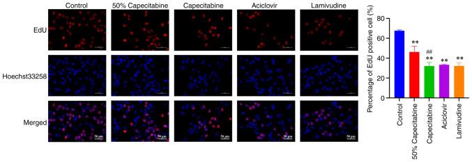 https://cdn.ncbi.nlm.nih.gov/pmc/blobs/4a67/12117538/ea732a43c05a/mmr-32-01-13568-g05.jpg