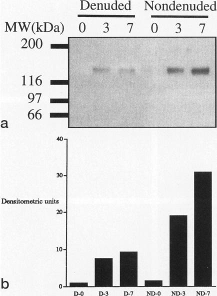 https://cdn.ncbi.nlm.nih.gov/pmc/blobs/4a68/1861513/ead48dd295c3/amjpathol00040-0177-a.jpg