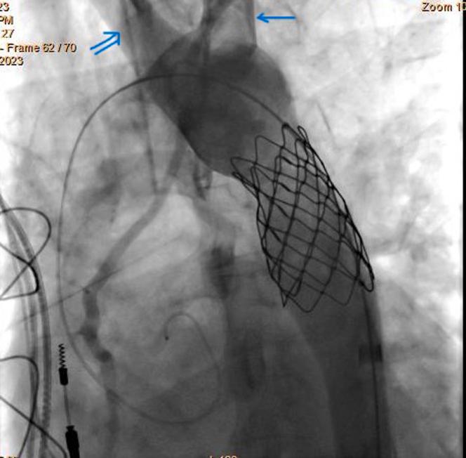 https://cdn.ncbi.nlm.nih.gov/pmc/blobs/4a69/12237713/056577af426d/gr3.jpg