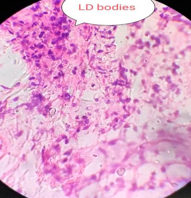 https://cdn.ncbi.nlm.nih.gov/pmc/blobs/4a6b/10729440/56b3782d7608/12879_2023_8918_Fig4_HTML.jpg