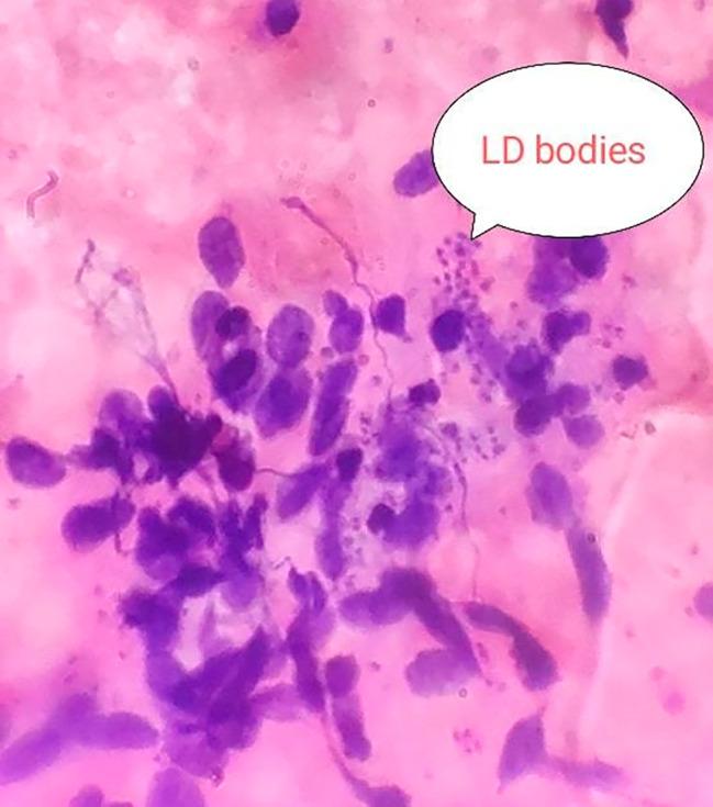 https://cdn.ncbi.nlm.nih.gov/pmc/blobs/4a6b/10729440/f39a433535c3/12879_2023_8918_Fig3_HTML.jpg