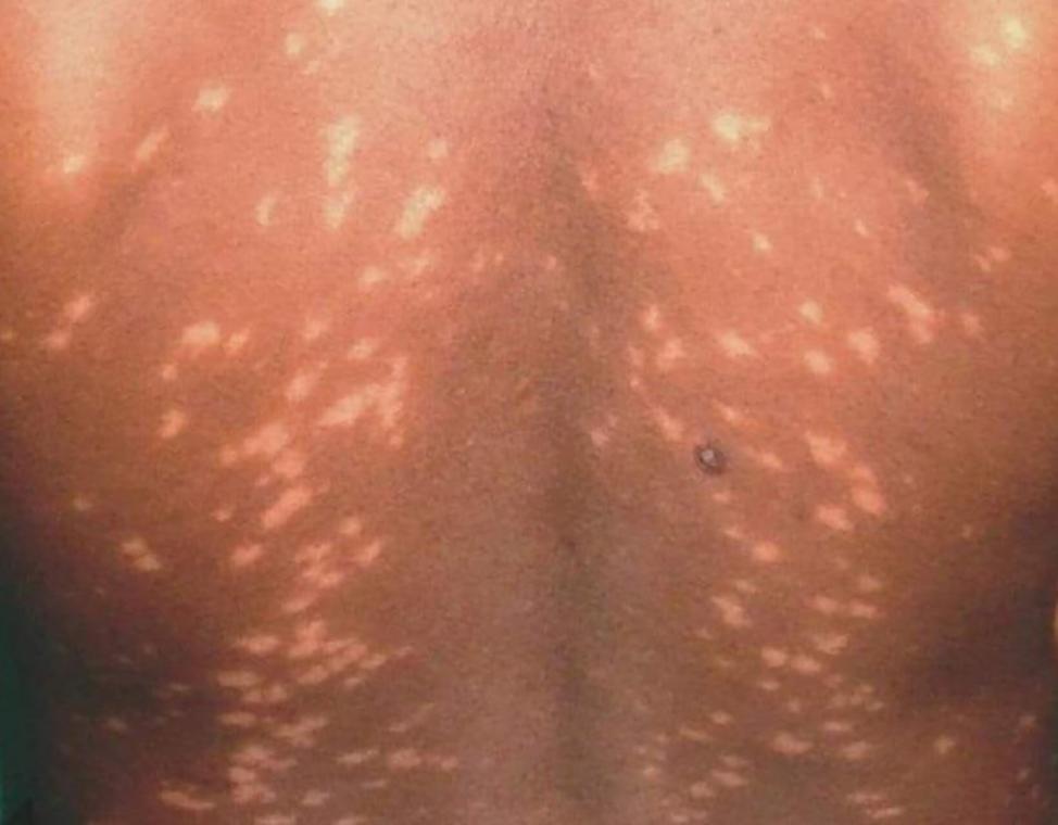 https://cdn.ncbi.nlm.nih.gov/pmc/blobs/4a6b/10729440/f8ba1cbe9208/12879_2023_8918_Fig1_HTML.jpg