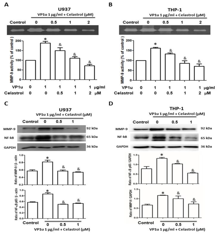 https://cdn.ncbi.nlm.nih.gov/pmc/blobs/4a6c/10607574/014a3cec702d/ijms-24-15294-g002.jpg