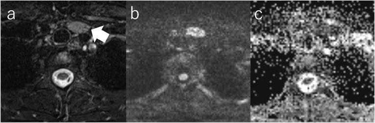 https://cdn.ncbi.nlm.nih.gov/pmc/blobs/4a74/9849419/e2cbbfd55f30/mrms-22-79-g3.jpg