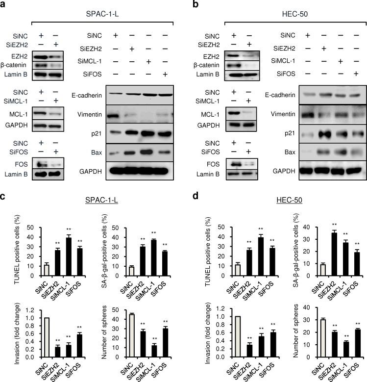 https://cdn.ncbi.nlm.nih.gov/pmc/blobs/4a7c/4171612/113e4750dc30/oncotarget-05-6049-g004.jpg