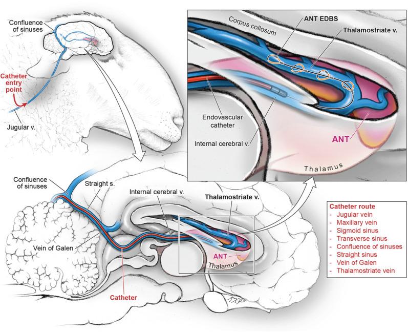 https://cdn.ncbi.nlm.nih.gov/pmc/blobs/4a82/11631012/c4c438bccd5e/ons-28-79-g001.jpg