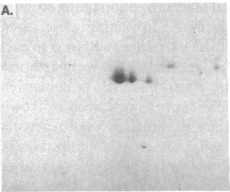 https://cdn.ncbi.nlm.nih.gov/pmc/blobs/4a8e/303517/0ed02a6dff95/jcinvest00079-0370-a.jpg