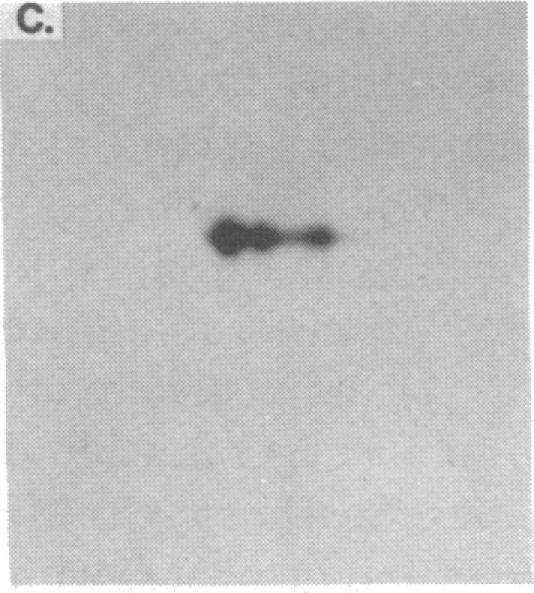 https://cdn.ncbi.nlm.nih.gov/pmc/blobs/4a8e/303517/daec418c9b48/jcinvest00079-0370-b.jpg