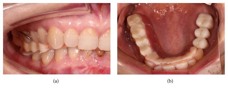 https://cdn.ncbi.nlm.nih.gov/pmc/blobs/4a8f/5587923/cae58469d9ae/CRID2017-9378091.003.jpg