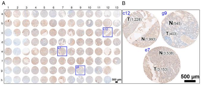https://cdn.ncbi.nlm.nih.gov/pmc/blobs/4a92/9945078/a63f38eefaf6/br-18-03-01604-g02.jpg