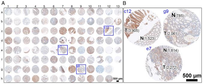 https://cdn.ncbi.nlm.nih.gov/pmc/blobs/4a92/9945078/f9e081c21c7f/br-18-03-01604-g05.jpg