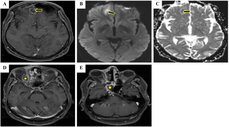 https://cdn.ncbi.nlm.nih.gov/pmc/blobs/4a96/10382720/6b3badd73f99/gr2.jpg
