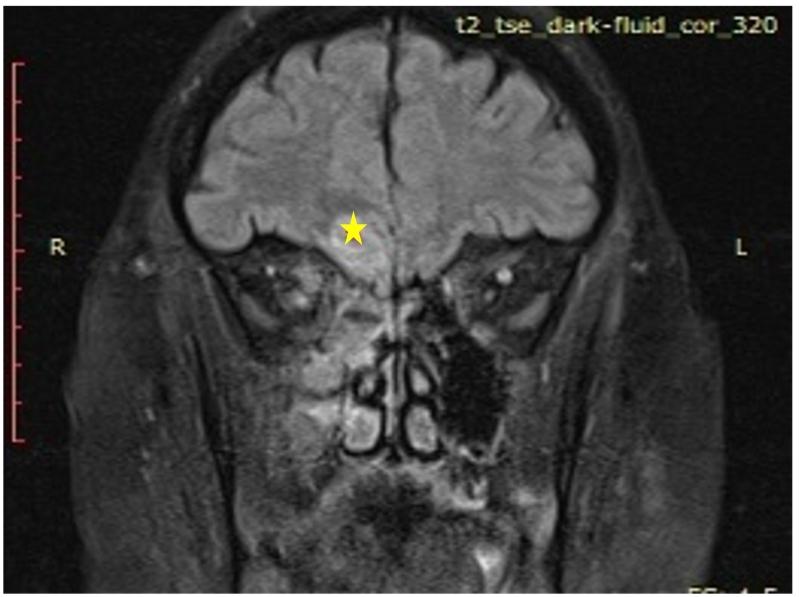https://cdn.ncbi.nlm.nih.gov/pmc/blobs/4a96/10382720/89bb87127166/gr4.jpg