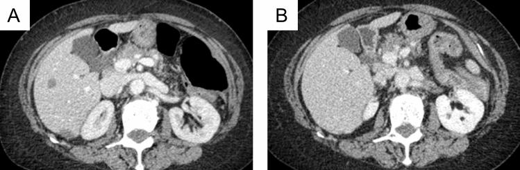 https://cdn.ncbi.nlm.nih.gov/pmc/blobs/4a96/11284183/522db7823b8f/12328_2024_1963_Fig4_HTML.jpg