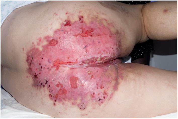 https://cdn.ncbi.nlm.nih.gov/pmc/blobs/4aa3/10332986/9aa5390a1cfe/IWJ-20-1954-g002.jpg