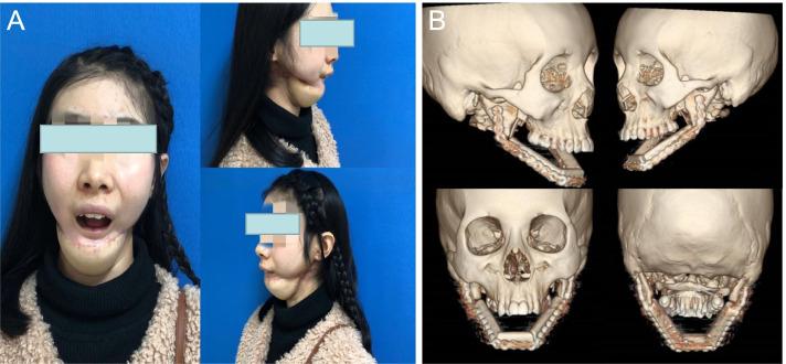 https://cdn.ncbi.nlm.nih.gov/pmc/blobs/4aaa/9245239/3bcd0a757767/12957_2022_2677_Fig5_HTML.jpg