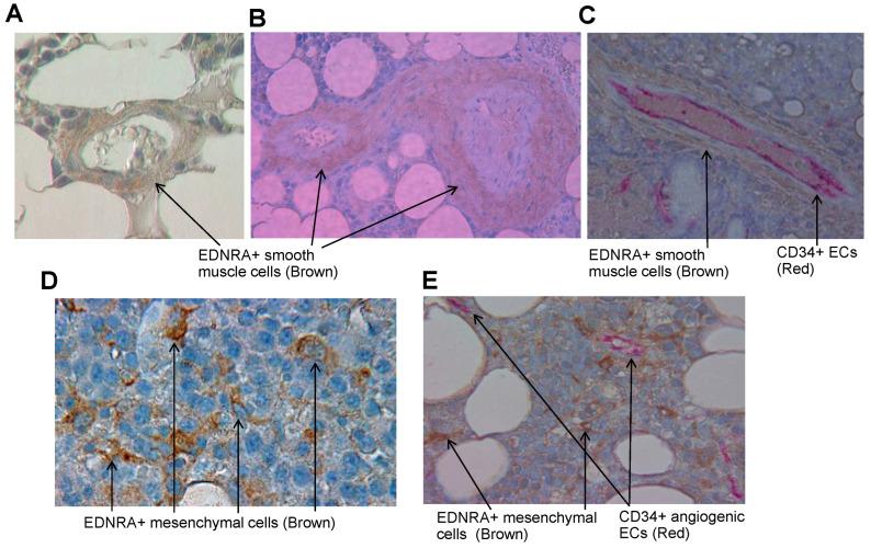 https://cdn.ncbi.nlm.nih.gov/pmc/blobs/4aad/10526862/e26d63b661a8/cancers-15-04519-g003.jpg