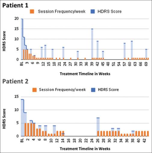 https://cdn.ncbi.nlm.nih.gov/pmc/blobs/4ab8/11382753/9559a2b4da8f/IJPsy-66-679-g001.jpg