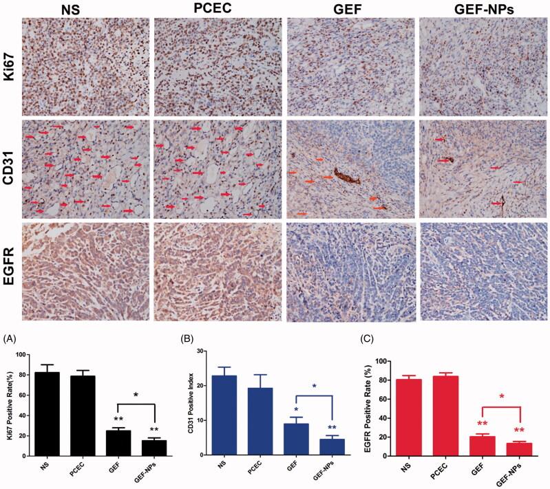 https://cdn.ncbi.nlm.nih.gov/pmc/blobs/4abc/8241075/f857f603161e/IDRD_A_1384862_F0005_C.jpg