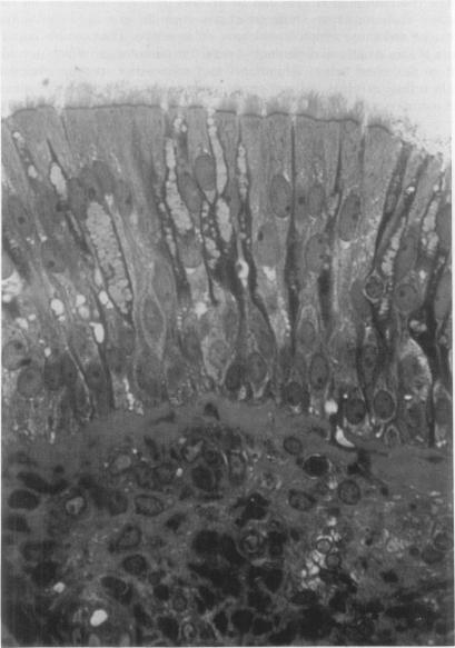 https://cdn.ncbi.nlm.nih.gov/pmc/blobs/4ac2/2279651/2e457d07db16/tacca00092-0209-a.jpg
