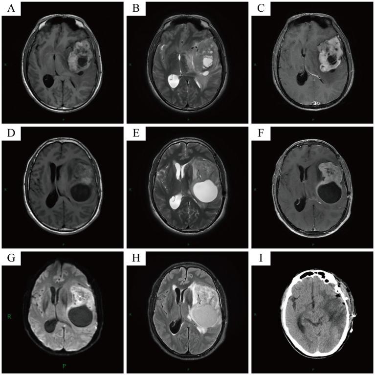 https://cdn.ncbi.nlm.nih.gov/pmc/blobs/4ac3/11994660/3a9984b2e11c/fonc-15-1551157-g002.jpg