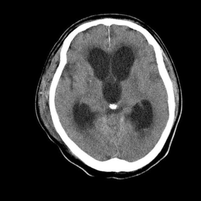 https://cdn.ncbi.nlm.nih.gov/pmc/blobs/4ac5/9728216/95f1f57ea9da/3653_Fig2.jpg
