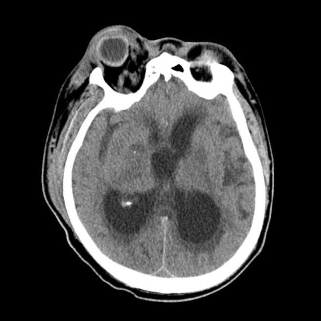 https://cdn.ncbi.nlm.nih.gov/pmc/blobs/4ac5/9728216/af5409884ac3/3653_Fig1.jpg