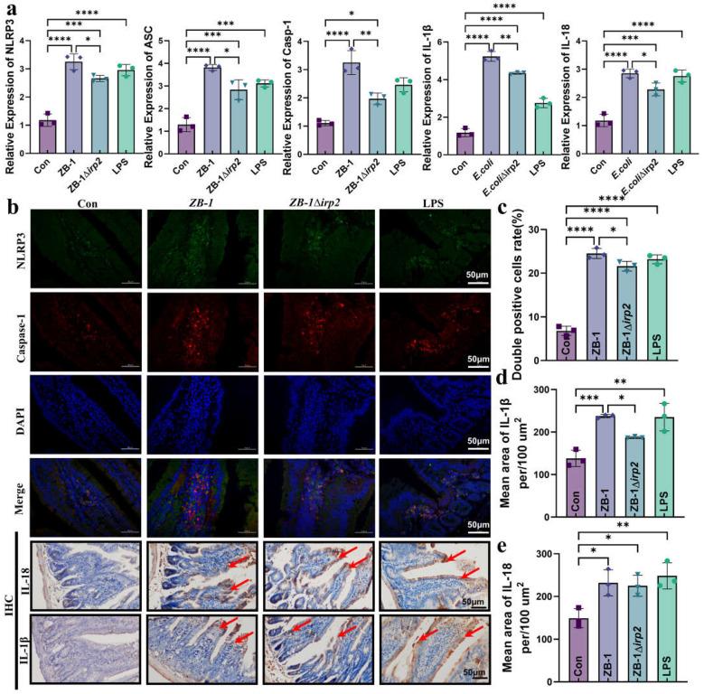 https://cdn.ncbi.nlm.nih.gov/pmc/blobs/4ac7/10380849/6e25447e231e/ijms-24-11451-g004.jpg