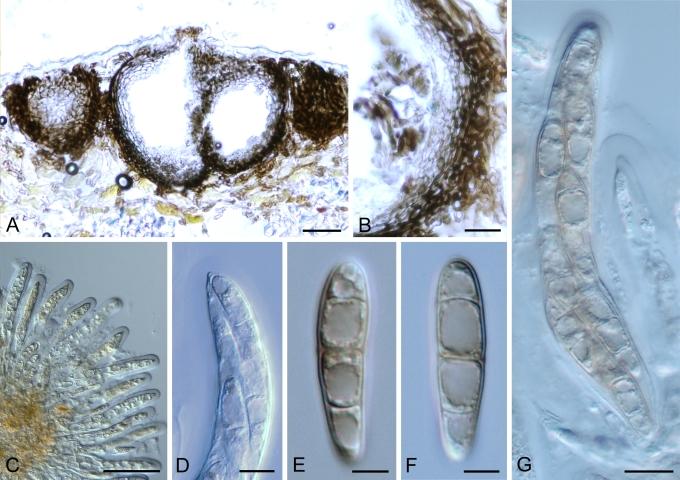 https://cdn.ncbi.nlm.nih.gov/pmc/blobs/4acd/2816965/572387653a5b/17fig3.jpg