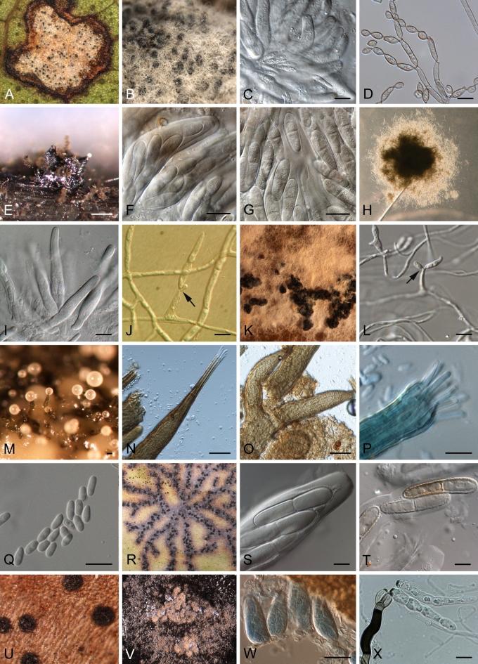 https://cdn.ncbi.nlm.nih.gov/pmc/blobs/4acd/2816965/ca7d591bee57/17fig13.jpg