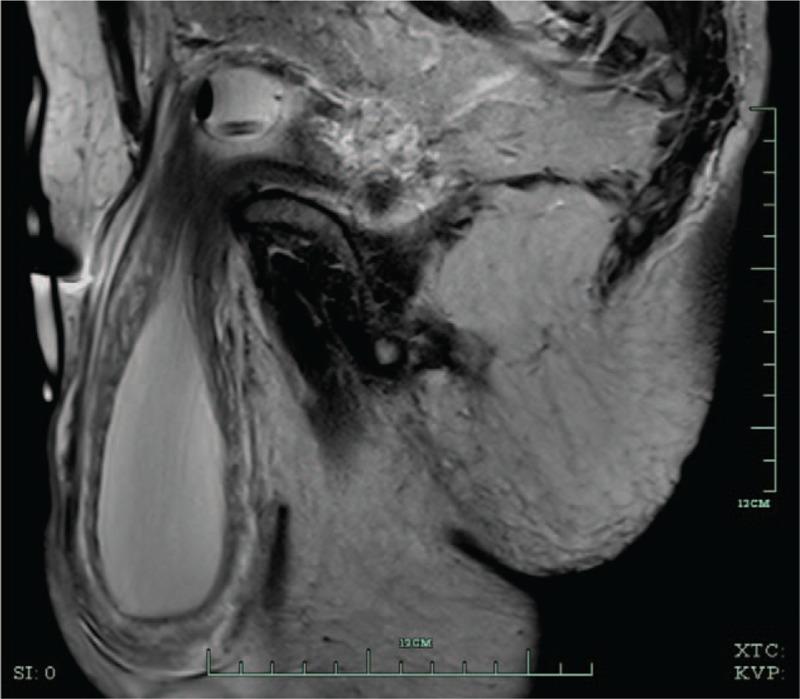 https://cdn.ncbi.nlm.nih.gov/pmc/blobs/4acd/5895406/d70a014917c3/medi-97-e9998-g004.jpg