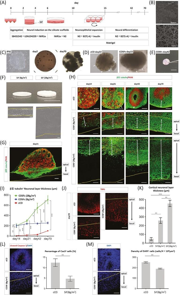 https://cdn.ncbi.nlm.nih.gov/pmc/blobs/4ace/10726412/2d14457d17cd/szad066_fig1.jpg