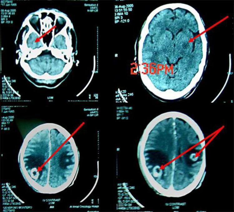 https://cdn.ncbi.nlm.nih.gov/pmc/blobs/4ad5/3884180/0a4bc80fc2aa/cde-0005-0272-g09.jpg